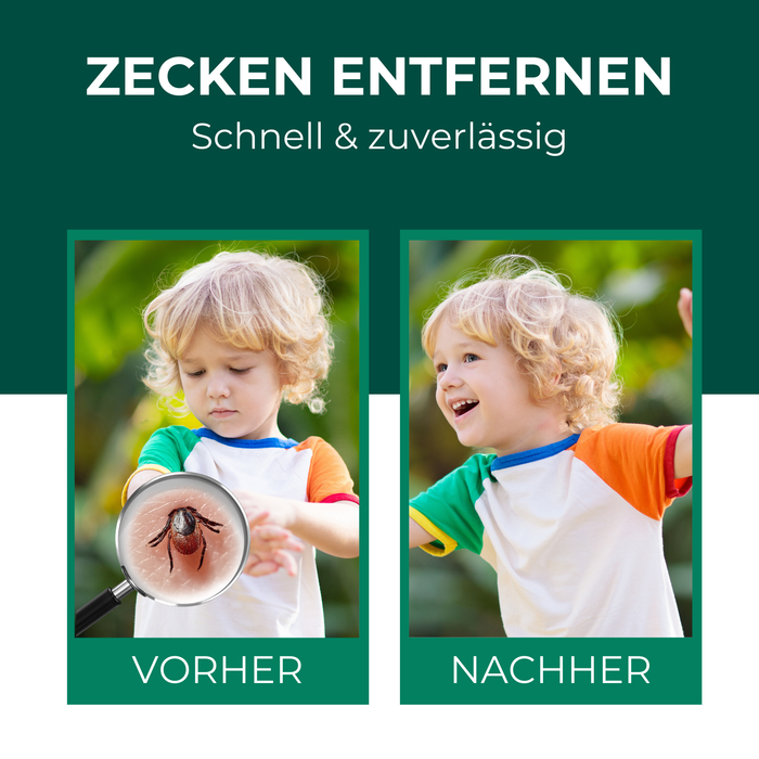 Zeckenzange Zeckenpinzette gegen Zecken