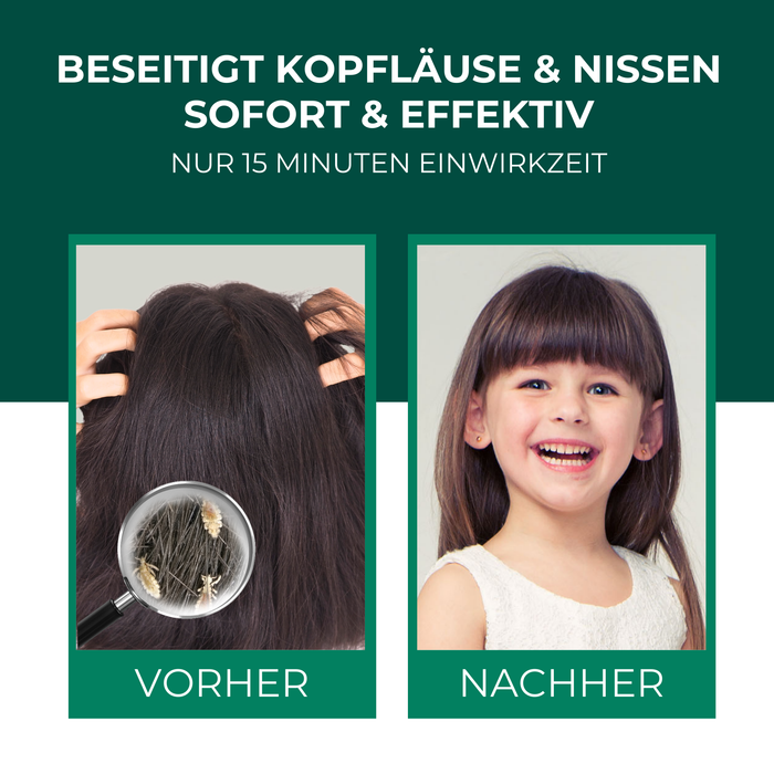 Kopfläuse-Shampoo - Läuseshampoo für Kinder & Erwachsene inkl. Nissenkamm Läuse Shampoo