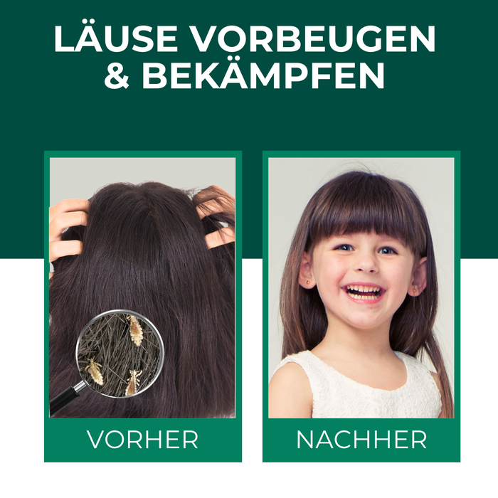 Vorher-Nachher-Darstellung zur Läusebekämpfung. Links ein Bild von dunklem Haar mit einer Lupe, die Läuse vergrößert zeigt. Rechts ein glückliches Mädchen mit glänzendem, läusefreiem Haar. Überschrift: „Läuse vorbeugen & bekämpfen