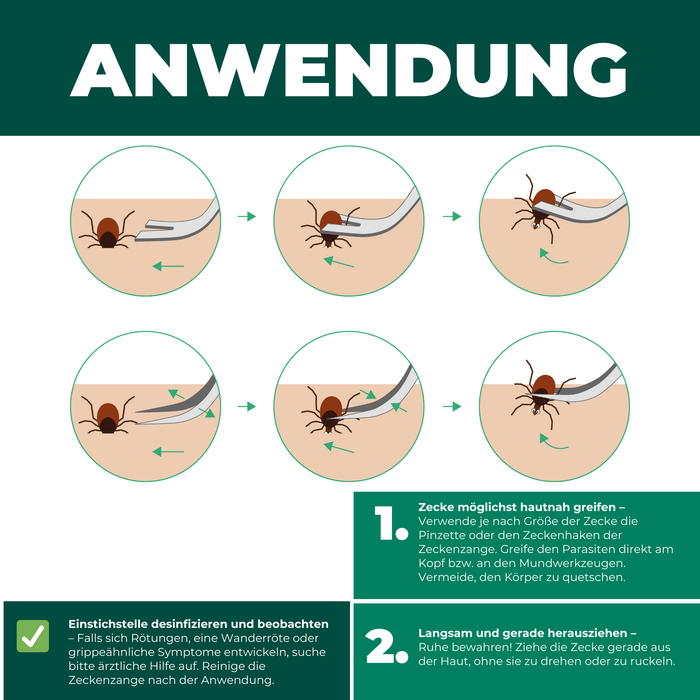 Zeckenzange Zeckenpinzette gegen Zecken