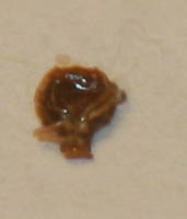 Bettwanze — Bild 3