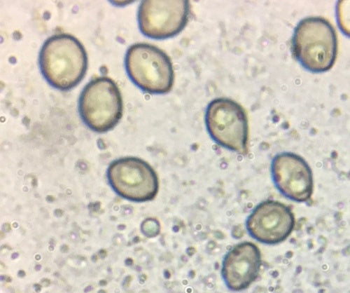Borstenkugelpilz — Bild 2 von 21