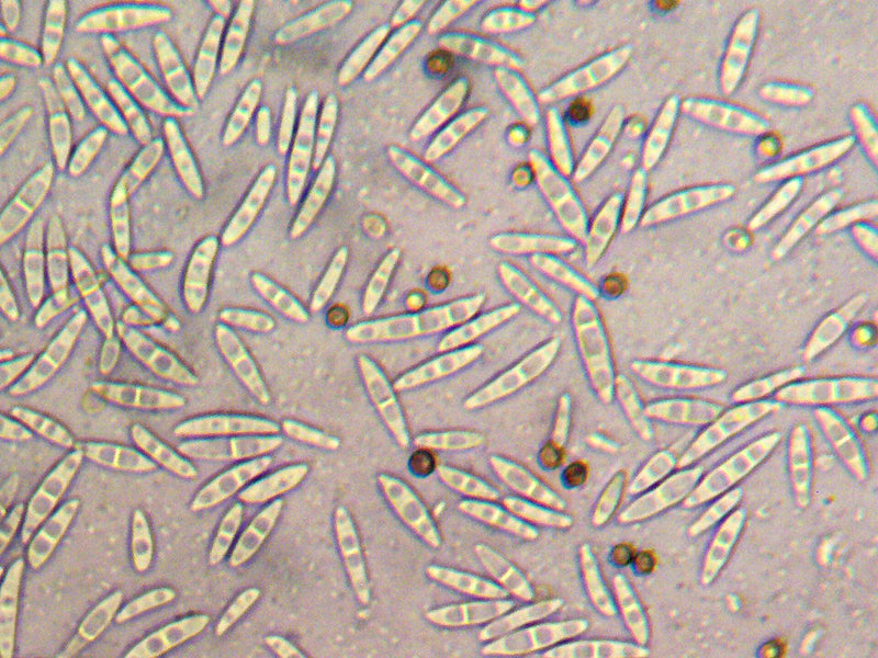 Fusarium-Schimmelpilze — Bild 1 von 8