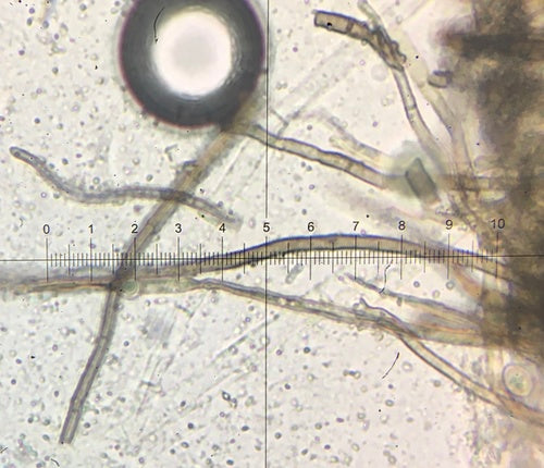 Kugeliger Borstenkugelpilz — Bild 3