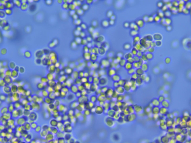 Mucor (Köpfchenschimmel) — Bild 2 von 2