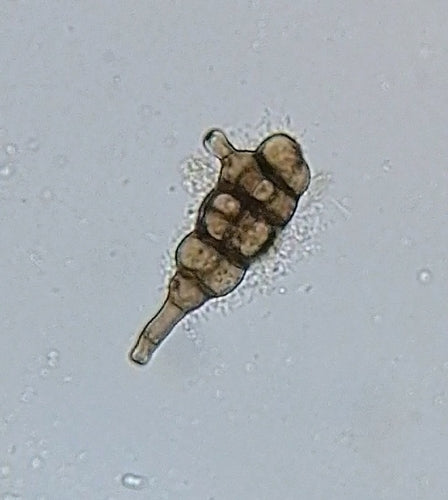 Ulocladium — Bild 5